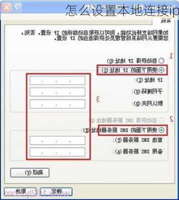 怎么设置本地连接ip